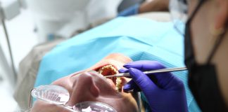 Do Mercury Fillings Raise Mercury Levels Throughout Your Body?