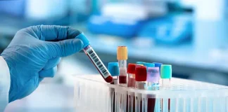 New Blood Test for Fatty Liver